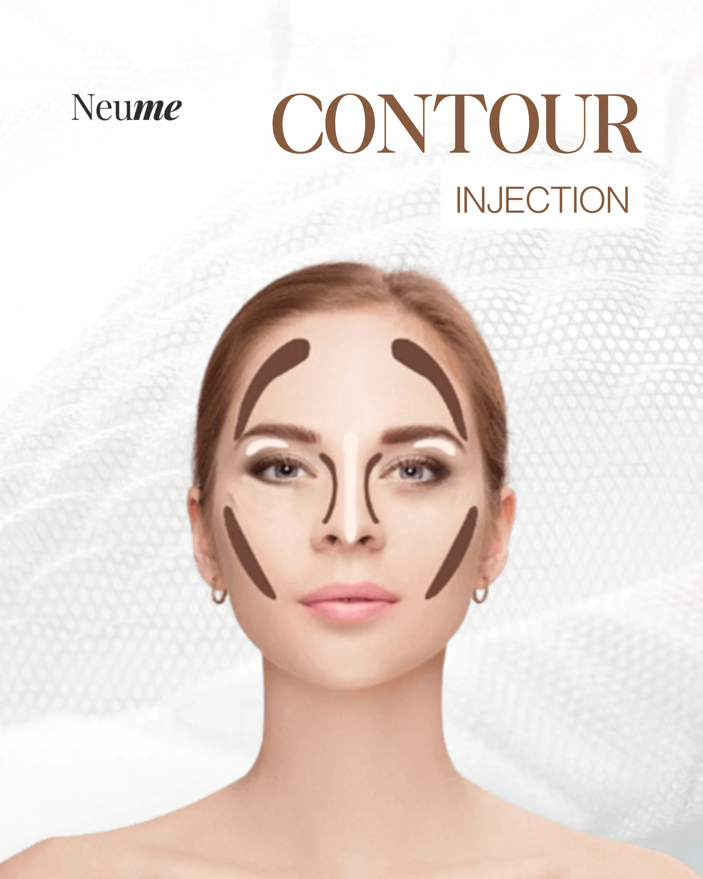 Contour Injection — Neume Services